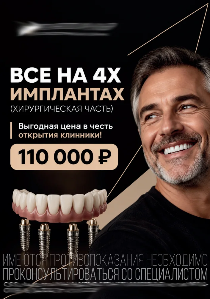 Имплантация под ключ