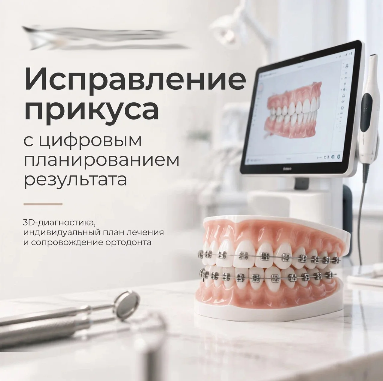Исправление прикуса с цифровой диагностикой