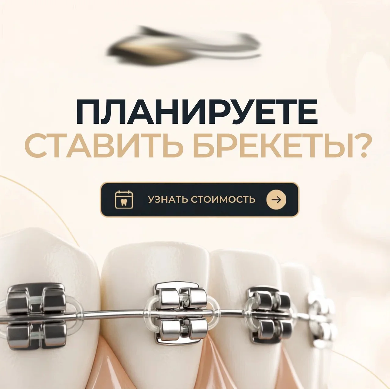 Планирование установки брекетов