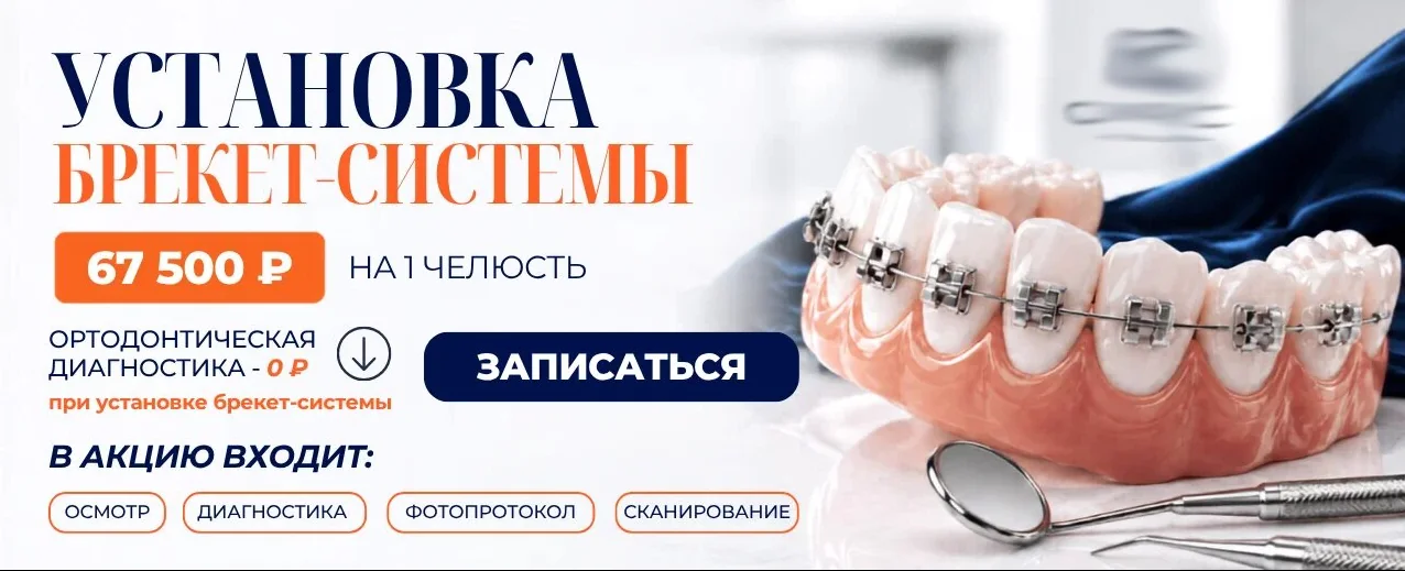 Баннер брекет-системы для ПроДокторов