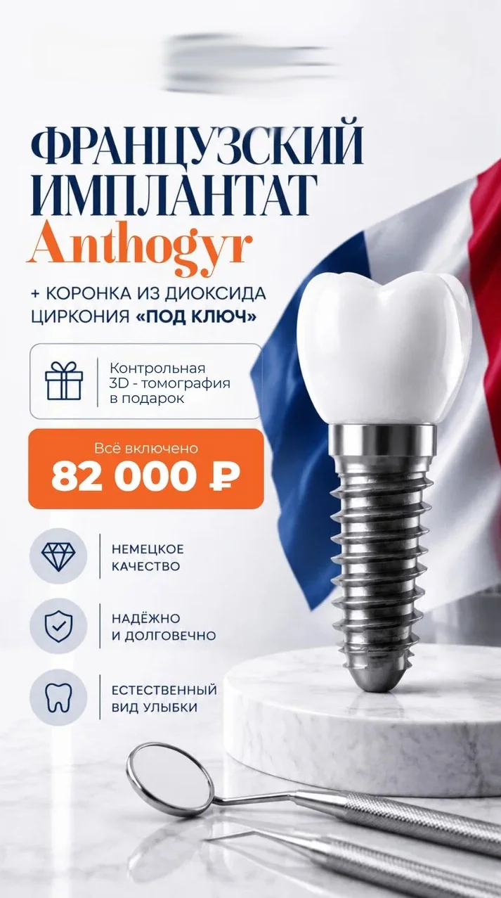 Имплантация Anthogyr