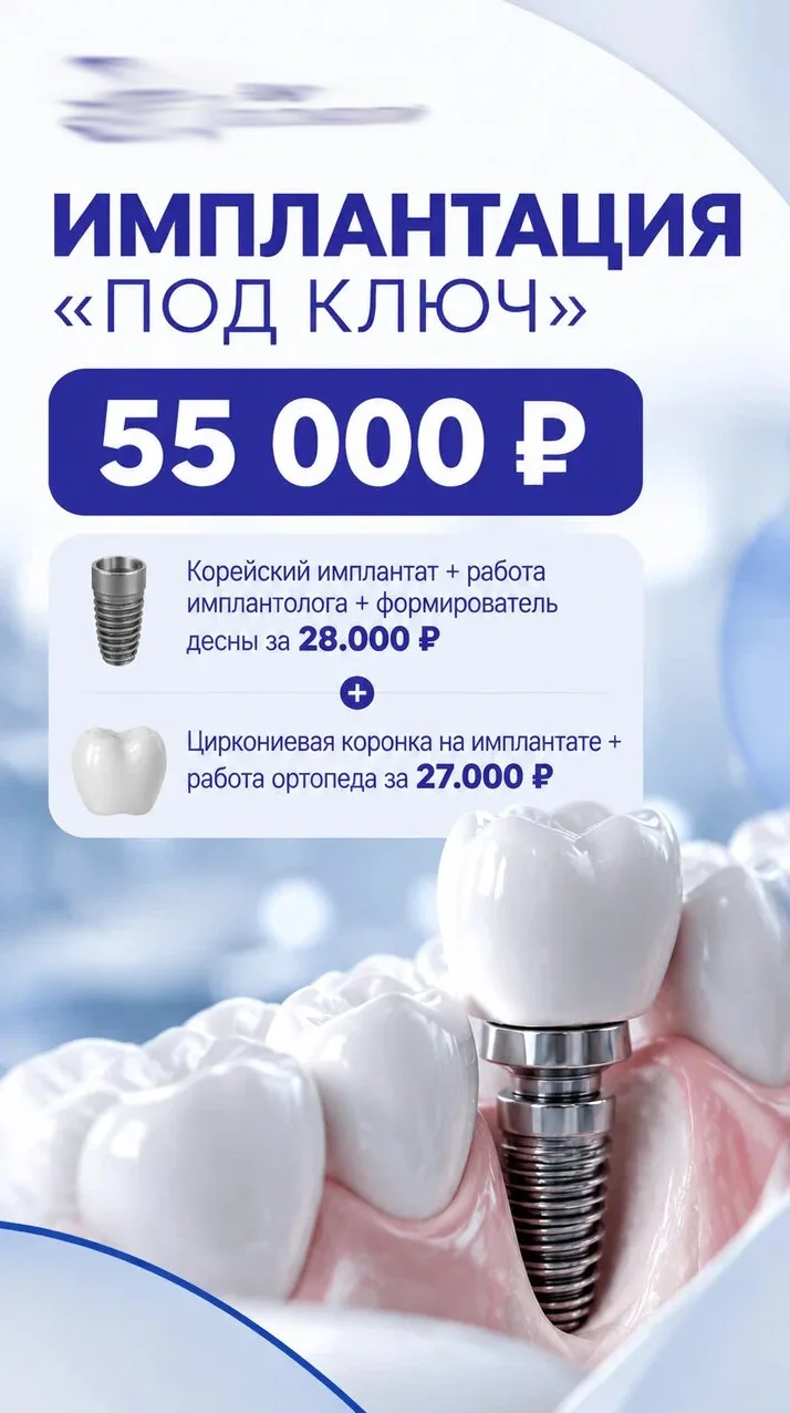Имплантация под ключ