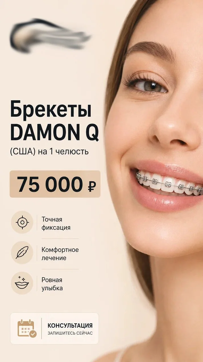 Брекеты Damon Q