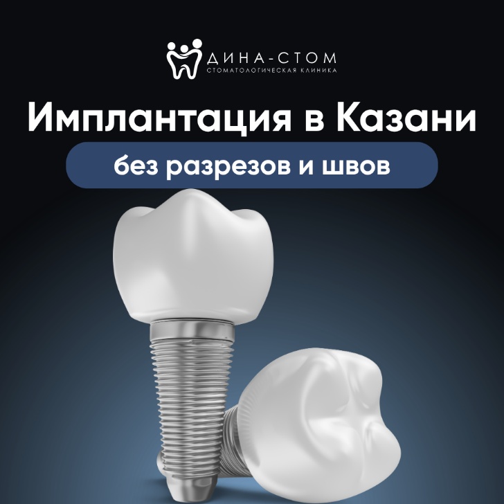 Рекламный креатив