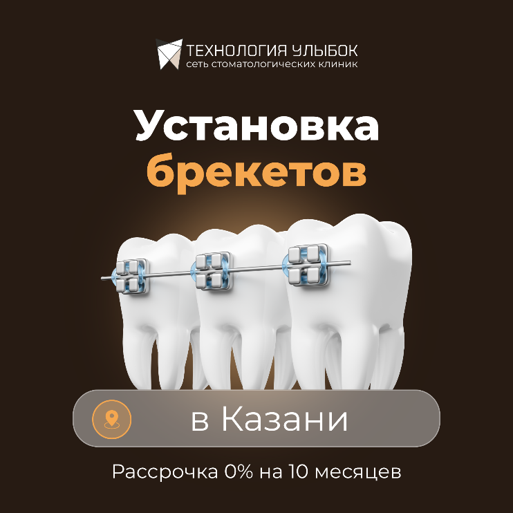Креатив