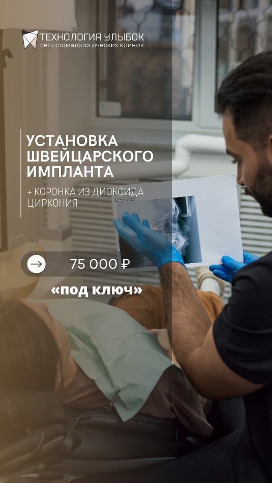 Сторис